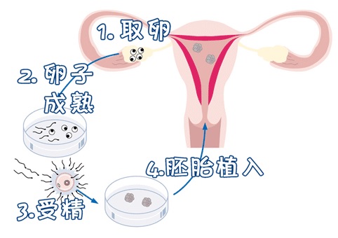 42岁高龄二胎成功案例